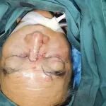 遭遇车祸面部&ldquo;皮开肉绽&rdquo;，骨科显微修复术后恢复如初