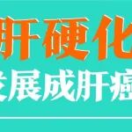 医学科普丨肝硬化会发展成肝癌吗？