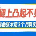 &ldquo;腿上凸起不见了！&rdquo;下肢静脉曲张术后3个月真实反馈