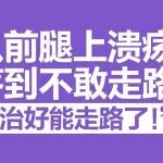 &ldquo;以前腿上溃疡疼到不敢走路，现在治好能走路了！&rdquo;