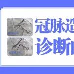 冠脉造影是冠心病诊断的&ldquo;金标准&rdquo;