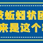双下肢大隐静脉曲张伴血栓，陕西冶金医院血管外科团队再出手