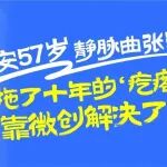 西安57岁静脉曲张患者：&ldquo;拖了十年的&lsquo;疙瘩腿&rsquo;靠微创解决了！&rdquo;