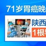 71岁胃癌晚期遭遇肠梗阻，陕西冶金医院消化内科1根导管解除肠道危机