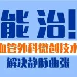 能治！25年静脉曲张让他站不住、睡不好，如今微创手术解除 &ldquo;腿上包袱&rdquo;